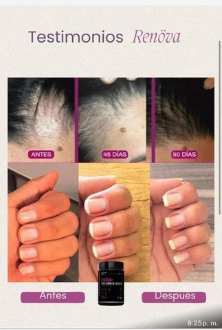 Image of COLAGENO RENOVA